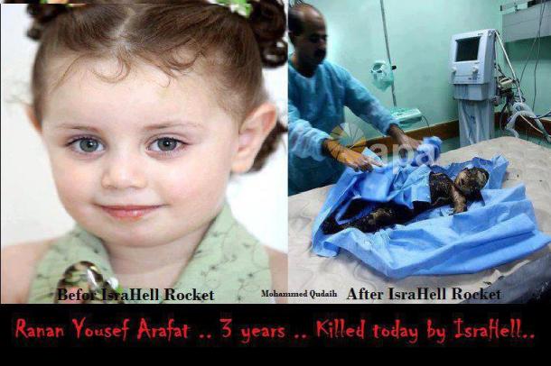 Anak Umur 3 Tahun Korban Kebiadaban Tentara Israel